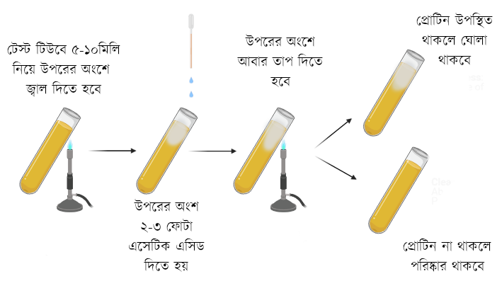 Heat coagulation test এর পদ্ধতি